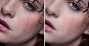 Photoshop Tutorials Photo Effects   How to Remove Acne in Photoshop  CS6