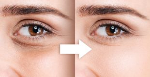 Naturally Remove Dark Circles with FS in Photoshop